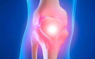 causes of knee joint arthrosis