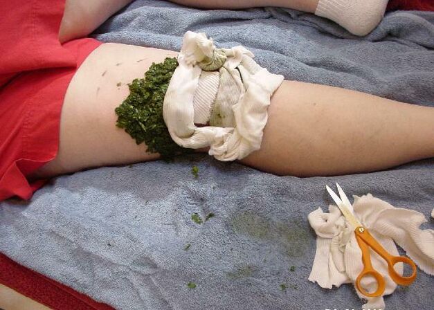 A warm compress of crushed cabbage leaves on a sore joint with arthrosis